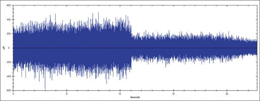 Using Ultrasound for Friction, Impacts and Turbulence