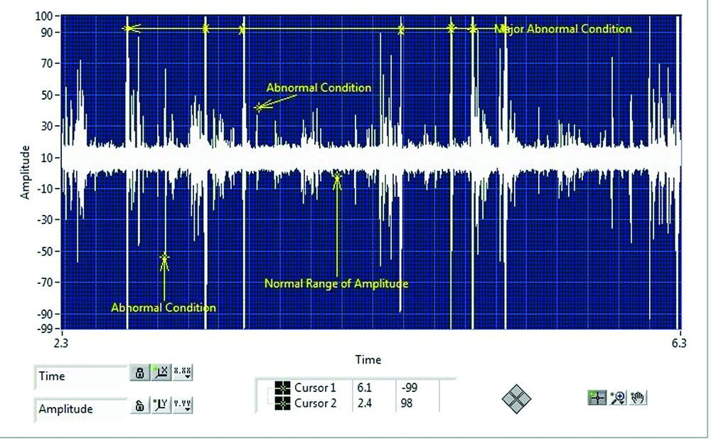 Diagnosing Mechanical and Electrical Faults Using Ultrasound Spectrum Analysis Asset
