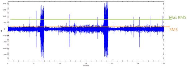 Ultrasound Detection and Condition Indicators in PdM