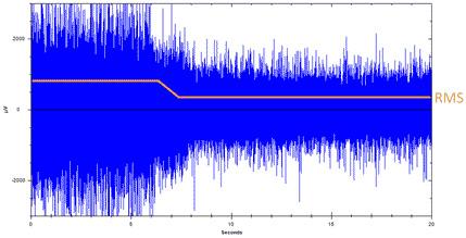 condition-indicators-rms